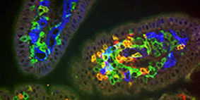 immunofluorescence cells